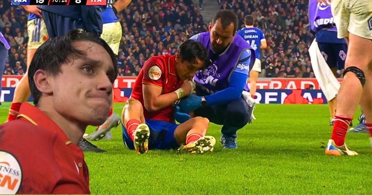 Ange Capuozzo s'est blessé face au XV de France. Screenshot : France 2