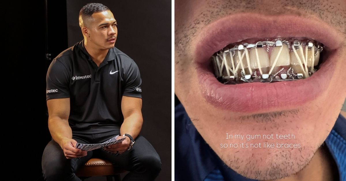 Mâchoire fracturée le 5 septembre, Cheslin Kolbe vise désormais son retour. Le calendrier lui laisse une vraie chance d’affronter la France en novembre. ©INPHO/Tom Maher - cheslinkolbe