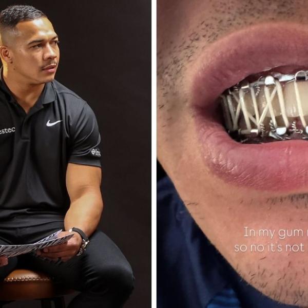 69 jours après, Cheslin Kolbe peut-il être remis pour affronter le XV de France en novembre ?