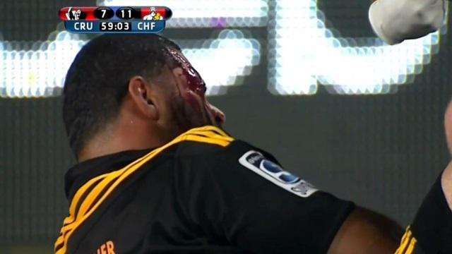 VIDEO. Le All Black Ben Afeaki envisage la retraite après un violent coup à la tête