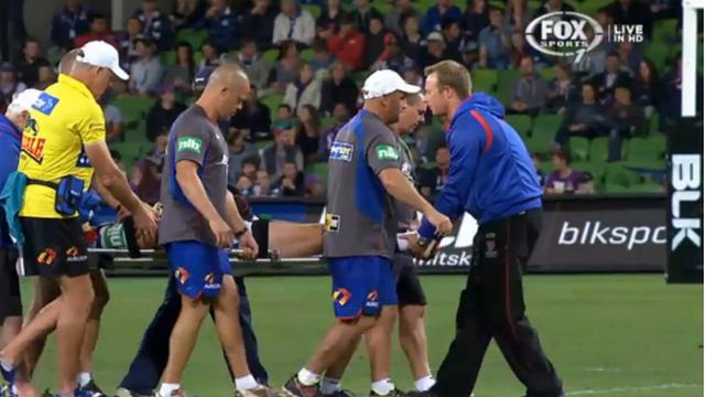 XIII. Alex McKinnon diagnostiqué tétraplégique après s'être brisé deux vertèbres sur un plaquage