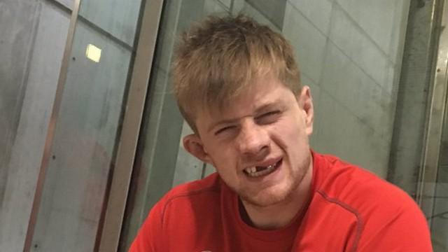 VIDEO. Top 14 - RCT. Andrew Cramond laisse ses dents sur la pelouse après un gros choc avec un coéquipier