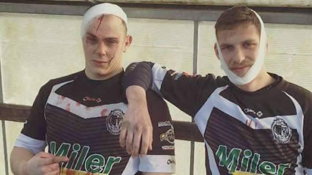 Insolite. Rugby amateur. Rencontre avec les deux balafrés de Bar-le-Duc