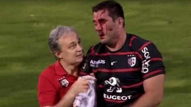 Top 14 - Les sorties définitives sur blessure ont augmenté de 40 % en trois ans