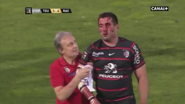 VIDEO. Top 14 - Barrage. L'impressionnante blessure de Florian Fritz du Stade Toulousain face au Racing-Métro