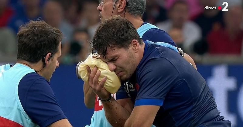 RUGBY. XV de France. Blessure Antoine Dupont : Vers une longue absence ou un forfait pour la Coupe du monde ?