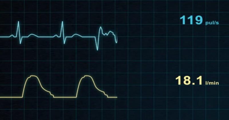 RUGBY - L'électrocardiogramme n'est plus obligatoire pour obtenir sa licence