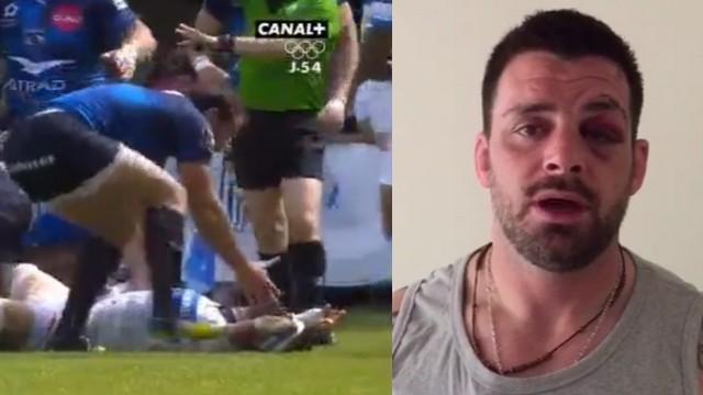 VIDEO. Top 14 - Castres. Rodrigo Capo-Ortega rassure les supporters après un KO spectaculaire